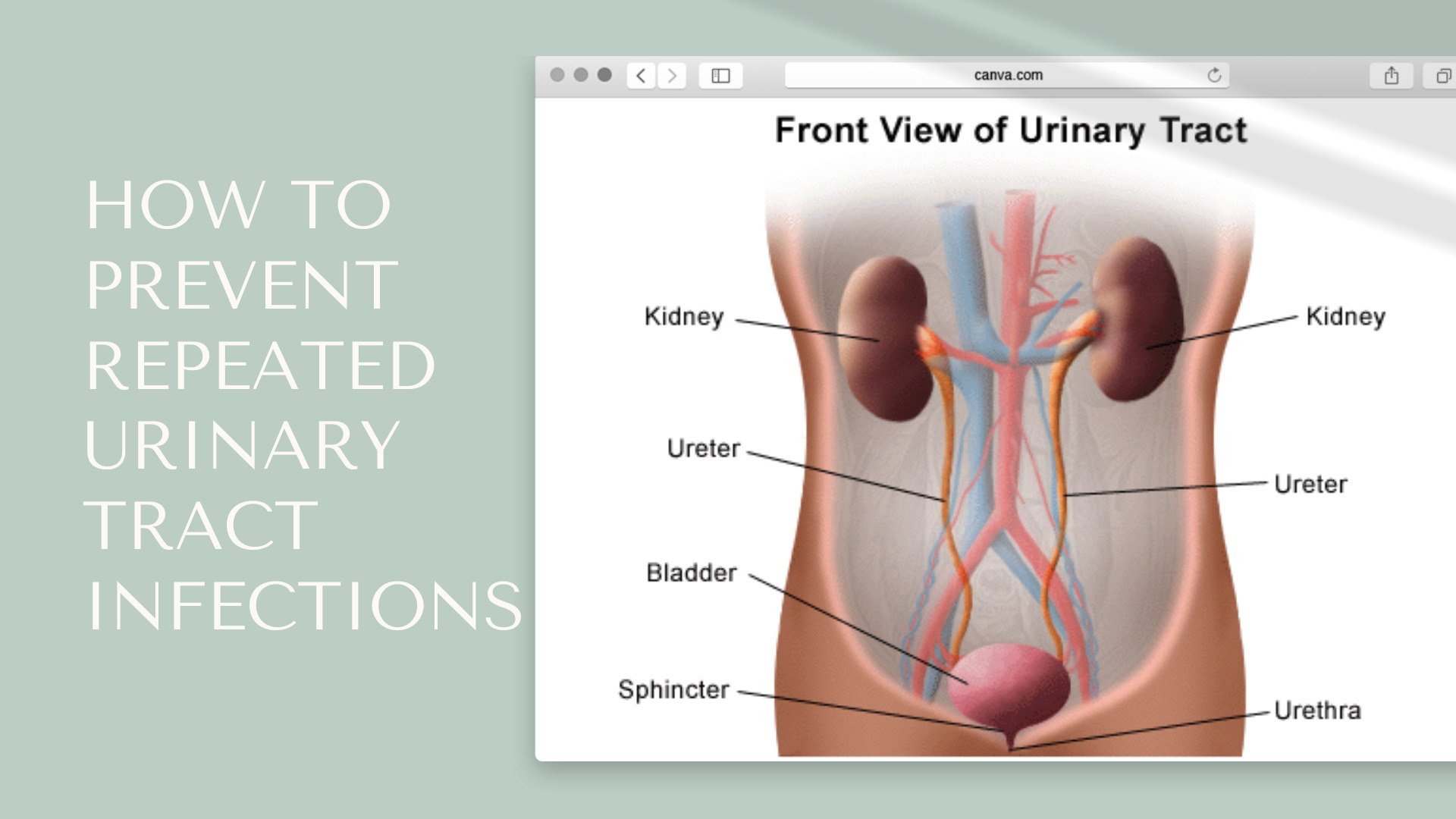 How to prevent urinary tract infections (UTI)? Balance