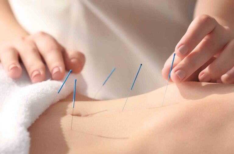 Home Balance Acupuncture & Herbs