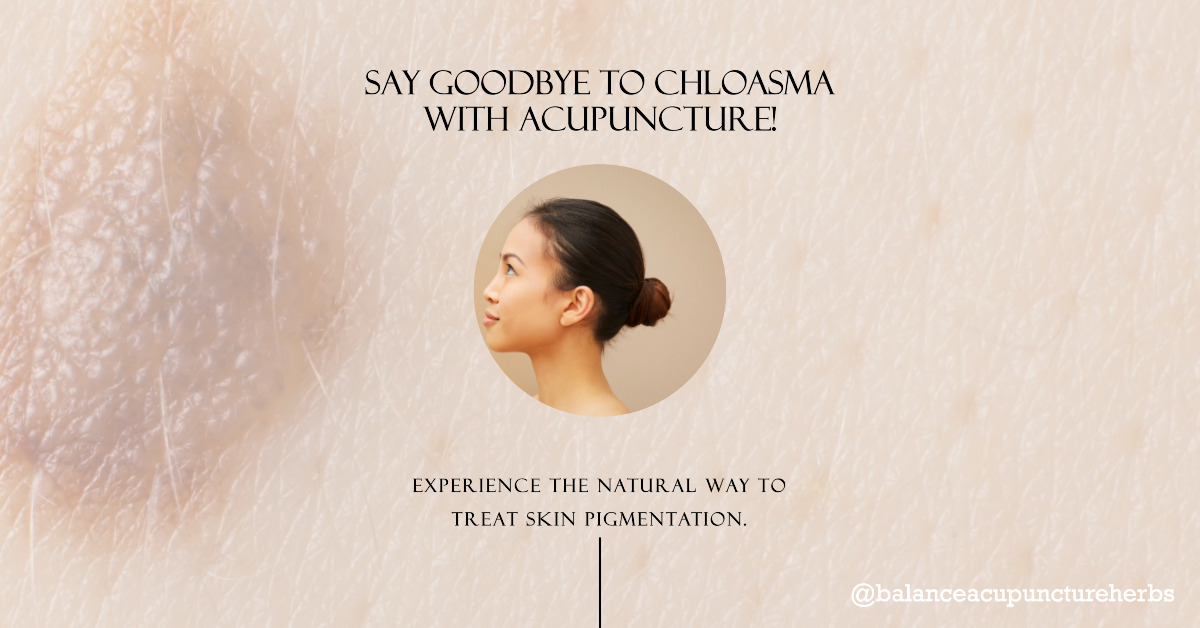 Chloasma; acupuncture; Skin condition