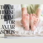 Acupuncture for plantar fasciitis